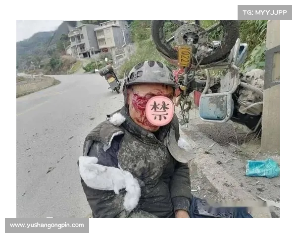 摩托车赛事突发致命撞击事故选手重伤生命垂危安全警钟长鸣 摩托车赛事突发致命撞击事故选手重伤生命垂危安全警钟长鸣